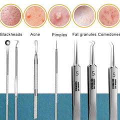 8pcs Ultra-fine Beauty Salon Acne Needle Tool Set My Store