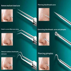 8pcs Ultra-fine Beauty Salon Acne Needle Tool Set My Store