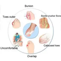 Bunion Corrector Silicone Toe Sleeves and Separator My Store